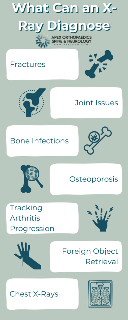 What can an x-ray diagnose