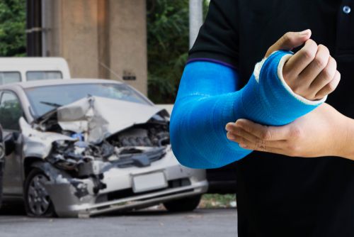 Car Accident Recovery, Car Accident Victim With Broken Arm