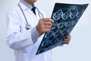 Minimally Invasive Orthopedic Surgery, Orthopedic Surgeon